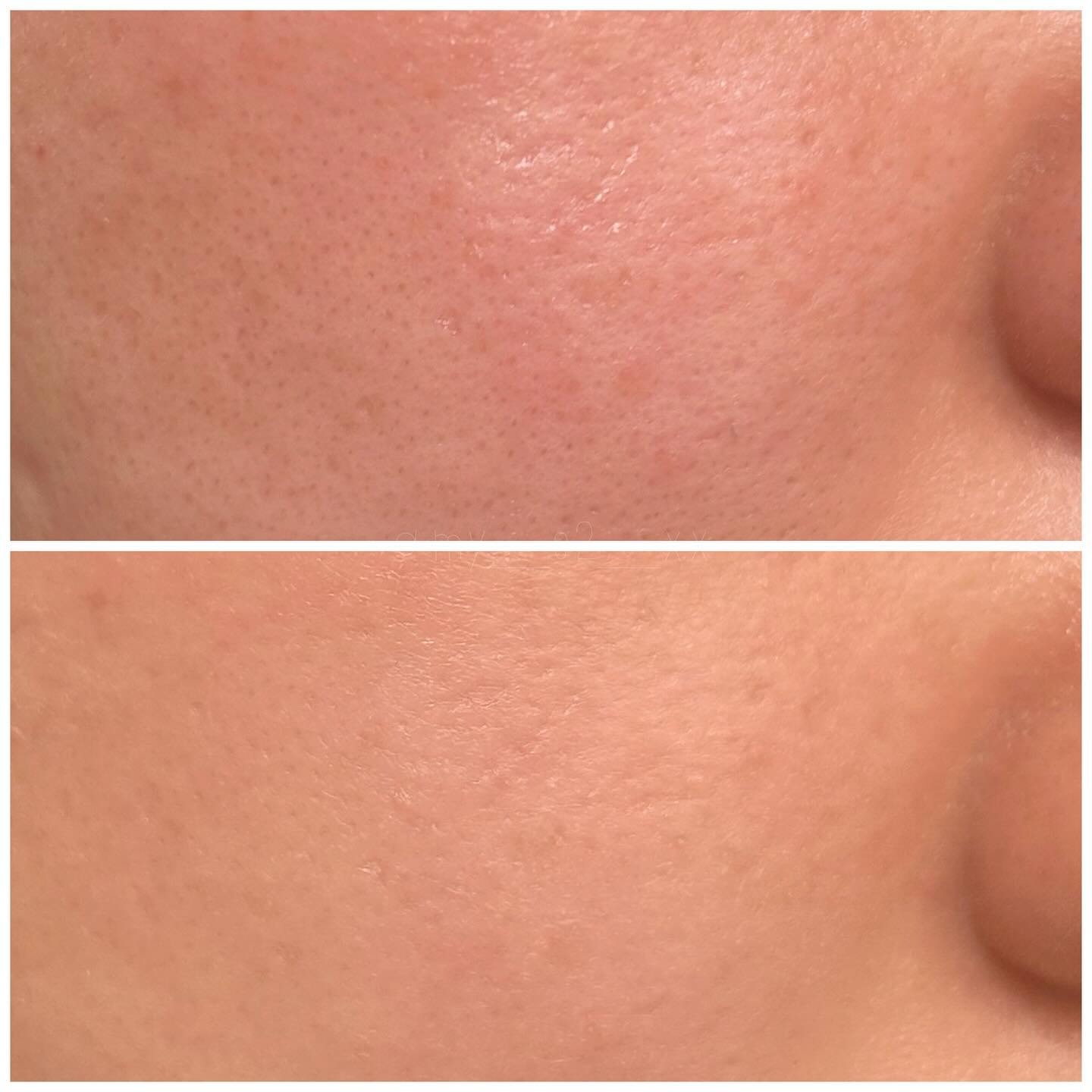 フィー クッションガラス ナチュラル/fwee/クッションファンデーションを使ったクチコミ（3枚目）