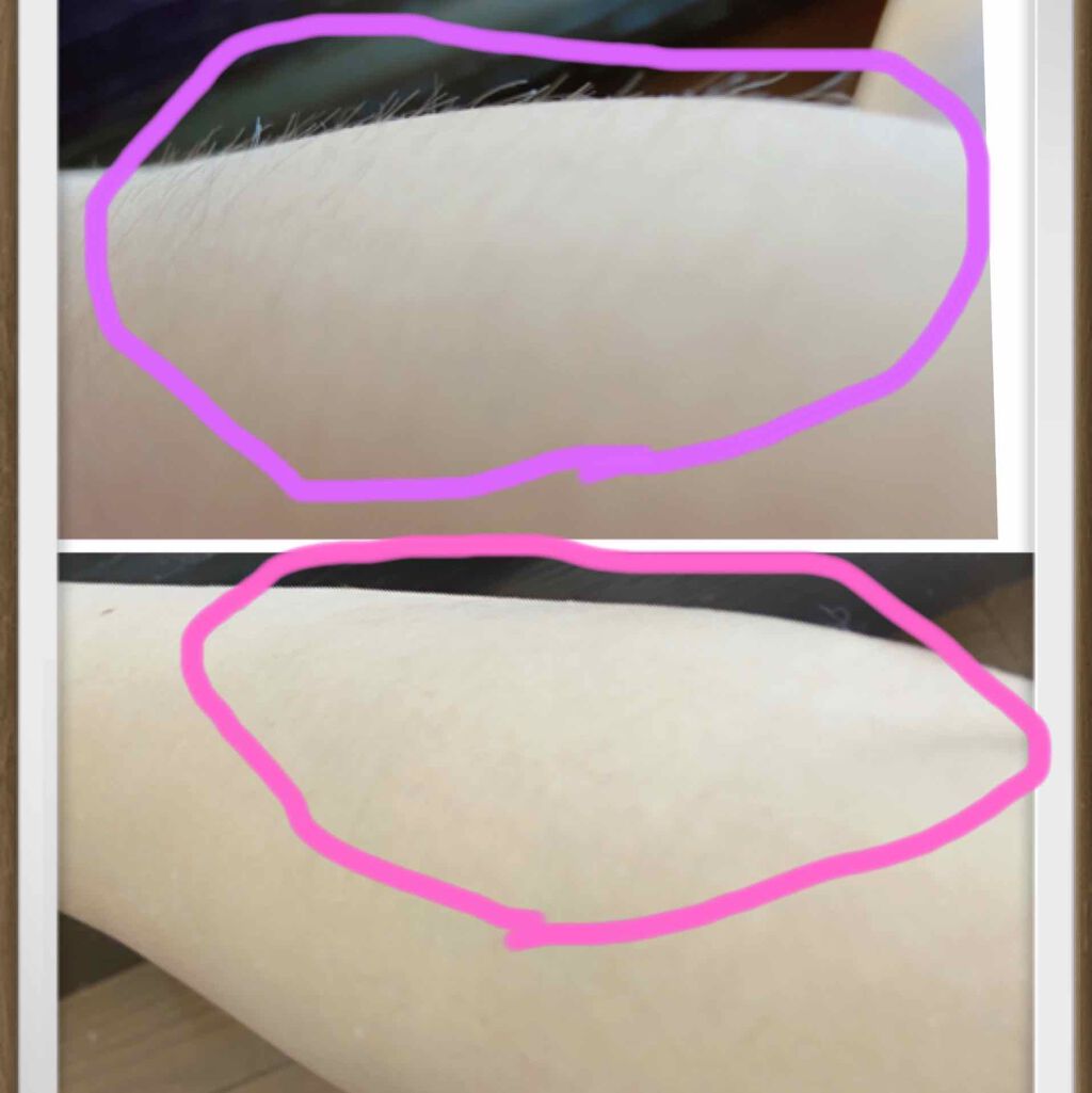 エクセルリムーバーフォーム/フォーシーズ/除毛クリームを使ったクチコミ(2枚目)