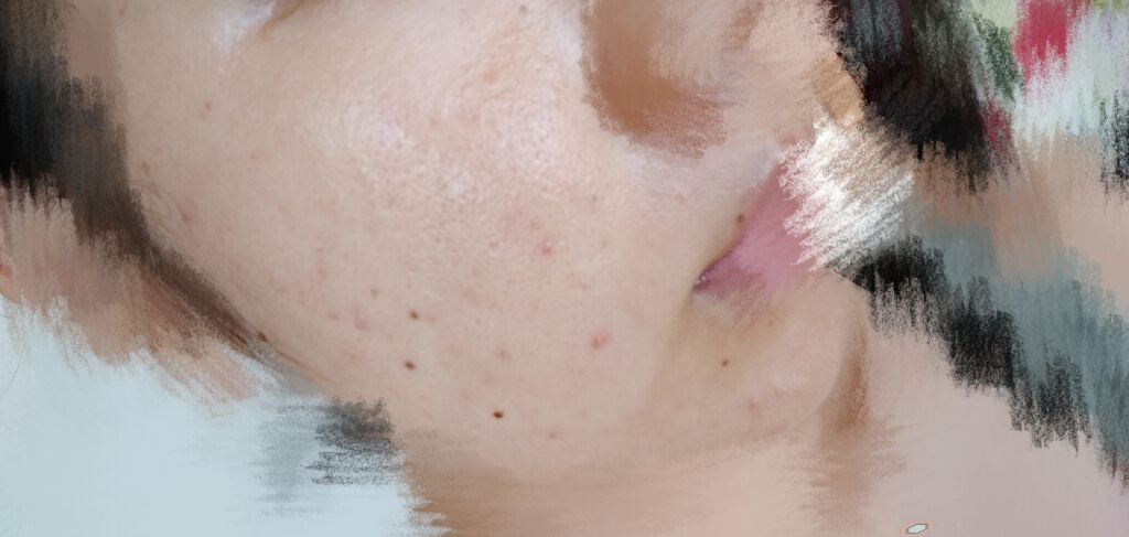 ハトムギ化粧水/麗白/化粧水を使ったクチコミ（2枚目）