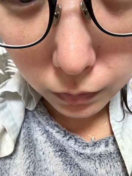 ホットブラックジェルクレンジング/.akaran/クレンジングジェルを使ったクチコミ(5枚目)