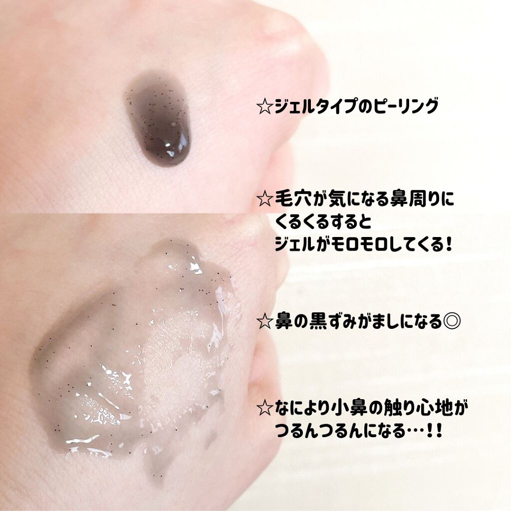 DETクリア ブライト&ピール ピーリングジェリー<炭タイプ>/Detclear/ピーリングを使ったクチコミ(3枚目)