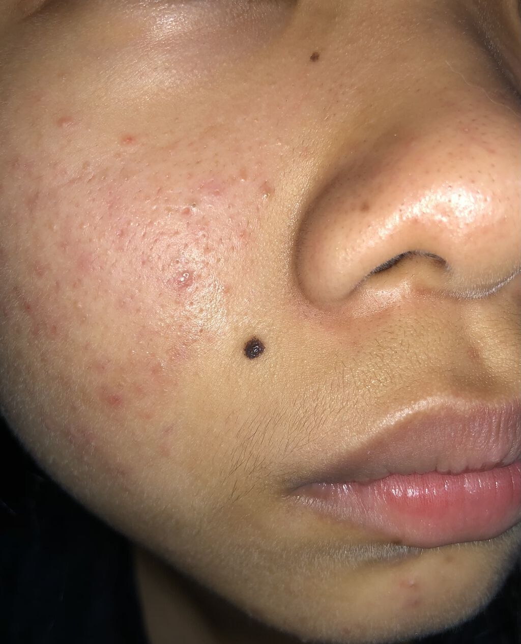 薬用保湿化粧水/オードムーゲ/化粧水を使ったクチコミ（2枚目）