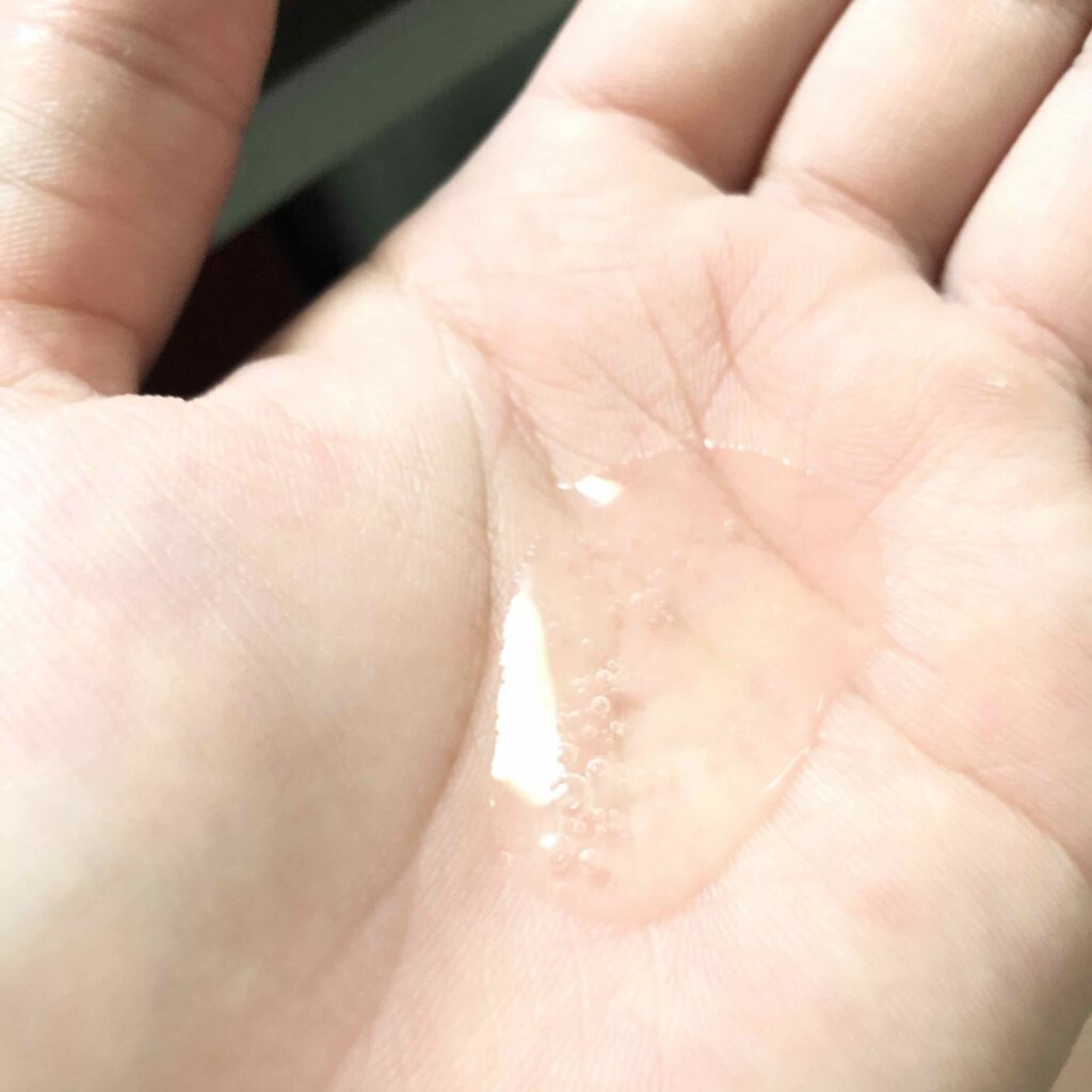 薬用アフターケアエッセンス/ミュゼコスメ/ボディローションを使ったクチコミ（2枚目）