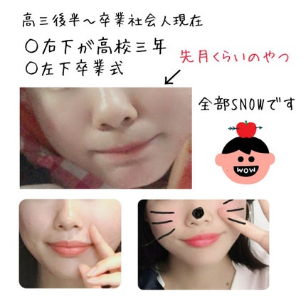 桂枝茯苓丸加ヨクイニン(医薬品)/ツムラ/その他を使ったクチコミ(3枚目)