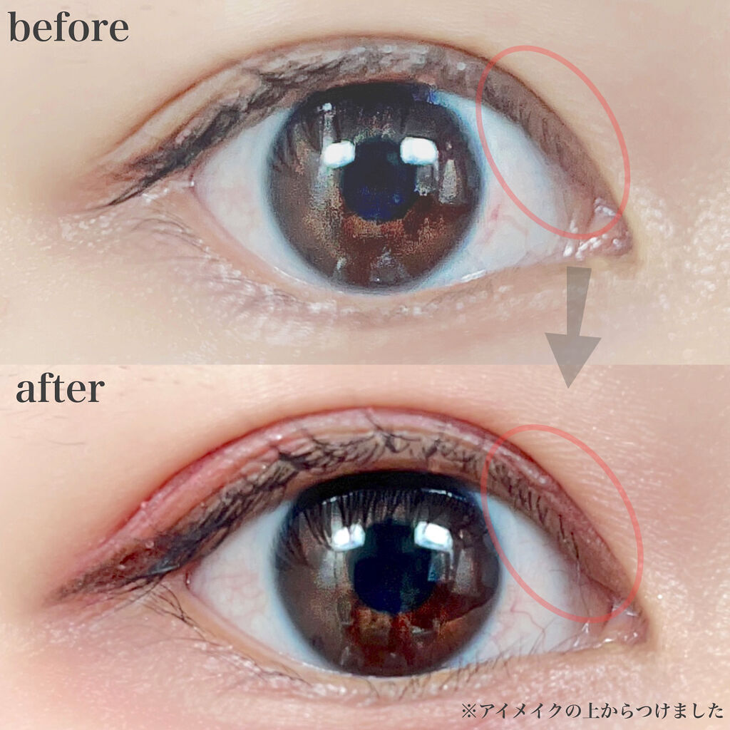 リキッドフィルム 2/ラクオリ/二重まぶた用アイテムを使ったクチコミ（2枚目）