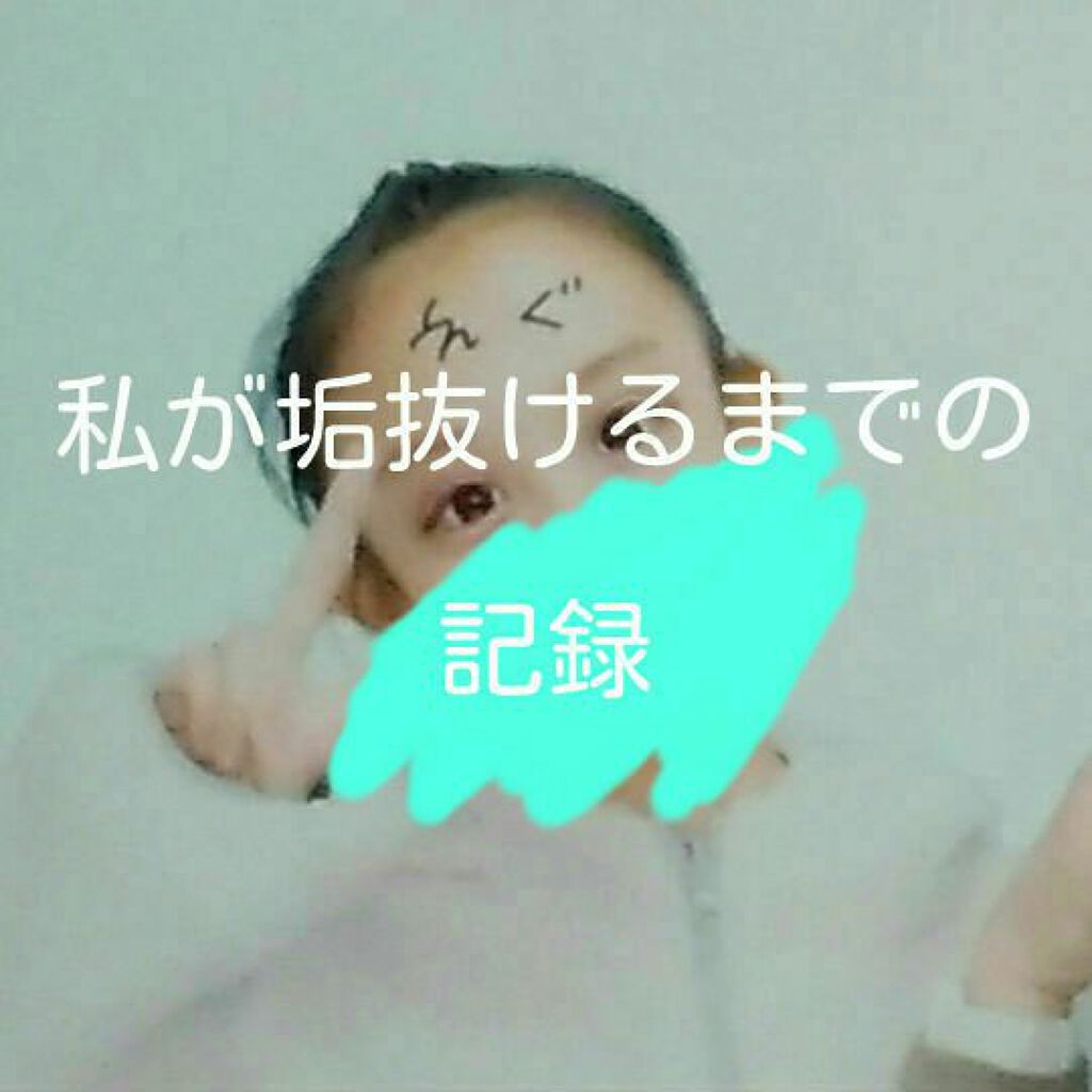 シローラクレイホワイトニング/Shirora/歯磨き粉を使ったクチコミ（1枚目）