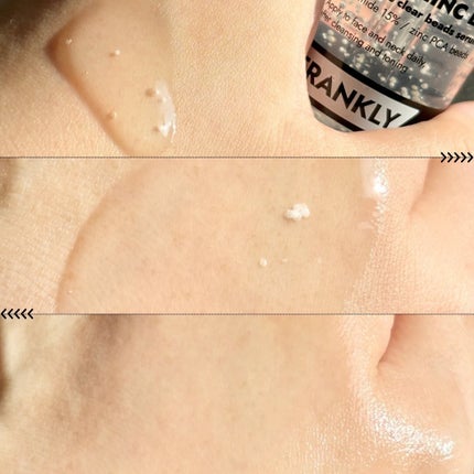 ナイアシンジンクビーズセラム/Frankly/美容液を使ったクチコミ(4枚目)