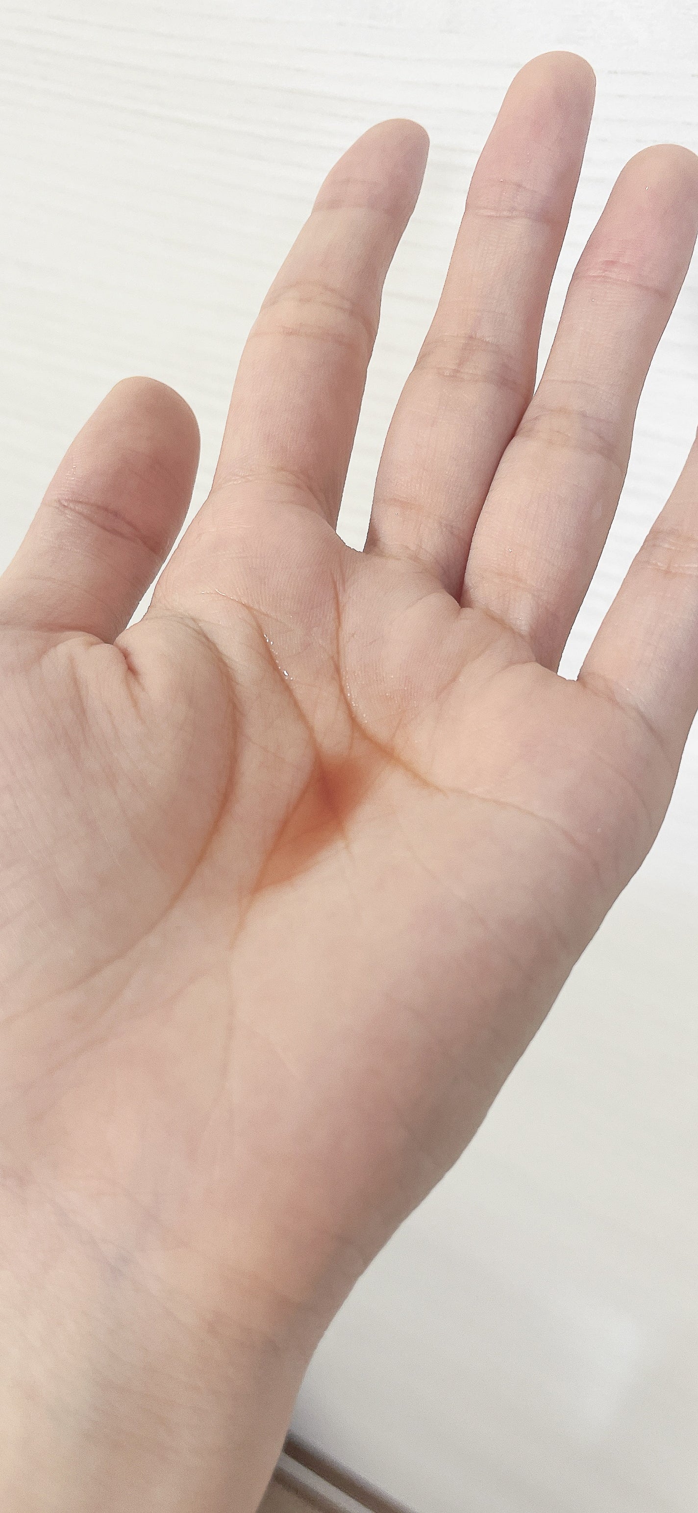 レッドアクネ ボディピーリングショット/MEDICUBE/ピーリングを使ったクチコミ(2枚目)