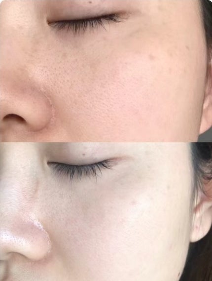 メラティノンクリーム/DERMA RESEARCH/フェイスクリームを使ったクチコミ(1枚目)