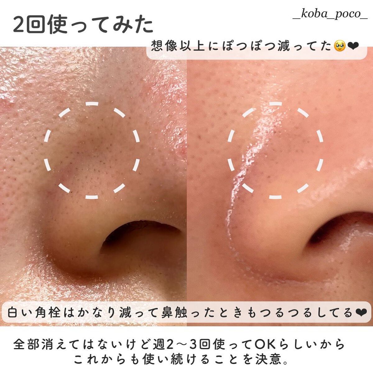 パーフェクトシーバムクレンジングジェル/Bonajour/クレンジングジェルを使ったクチコミ(5枚目)