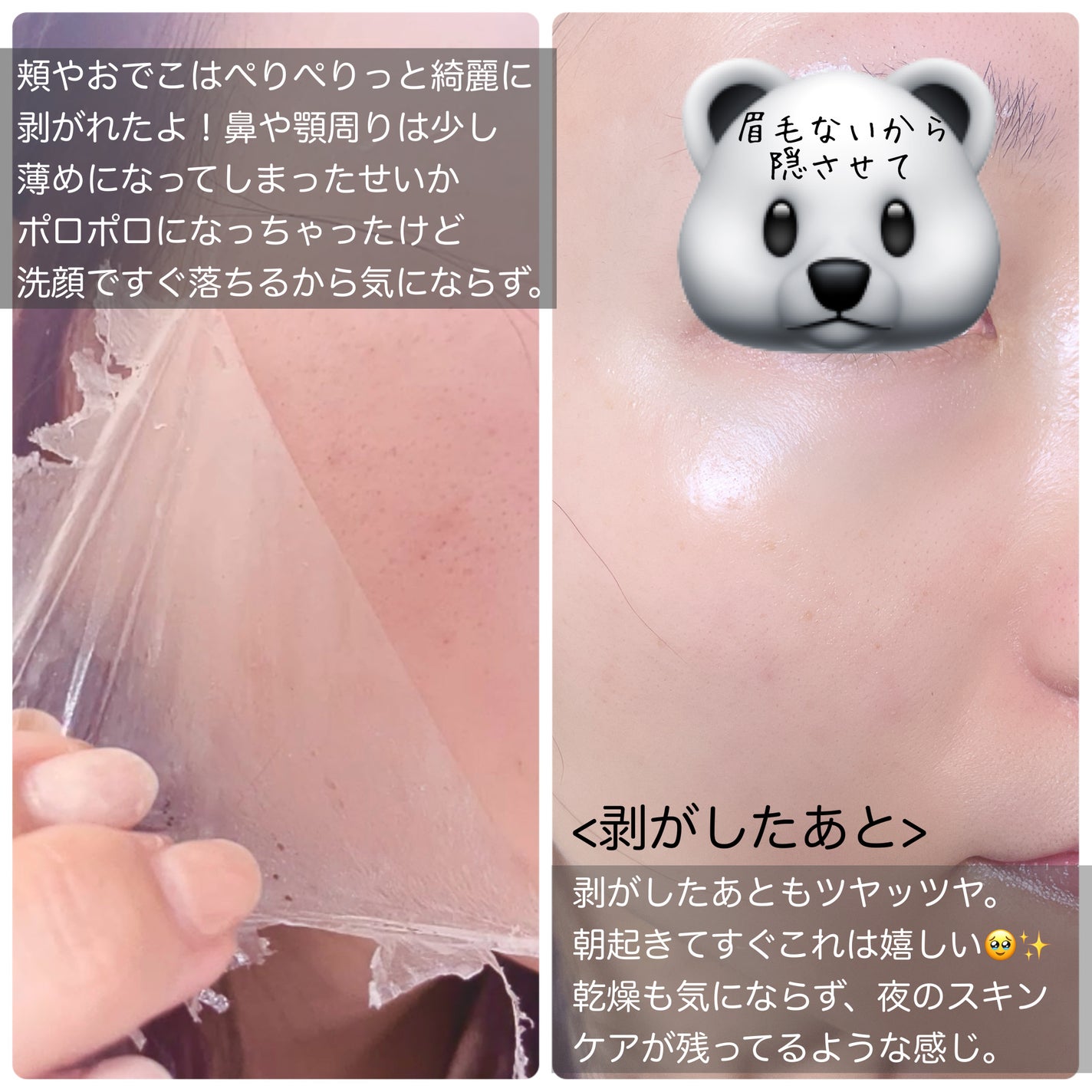 レッドラクトコラーゲンラッピングマスク/MEDIPEEL/シートマスク・パックを使ったクチコミ(4枚目)