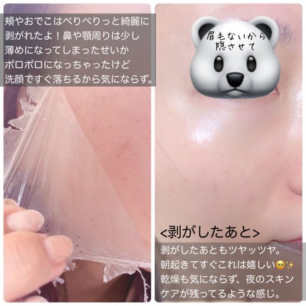 レッドラクトコラーゲンラッピングマスク/MEDIPEEL/シートマスク・パックを使ったクチコミ(4枚目)