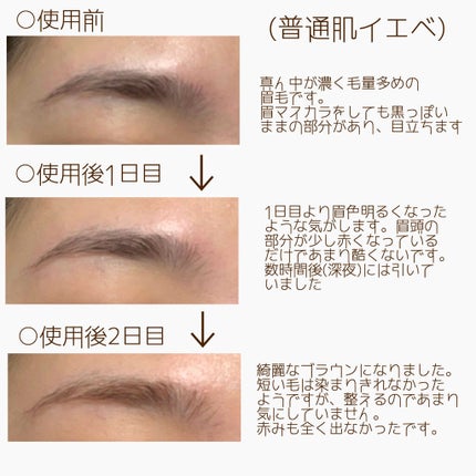 脱色クリーム 敏感肌用/エピラット/ムダ毛ケアを使ったクチコミ(3枚目)