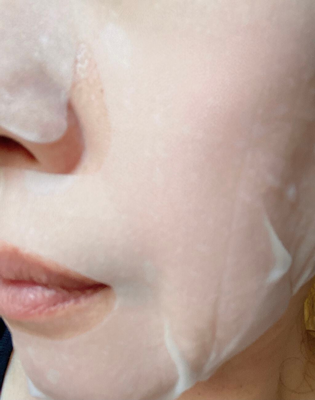 フェイシャルマスク /EUREA /シートマスク・パックを使ったクチコミ(6枚目)