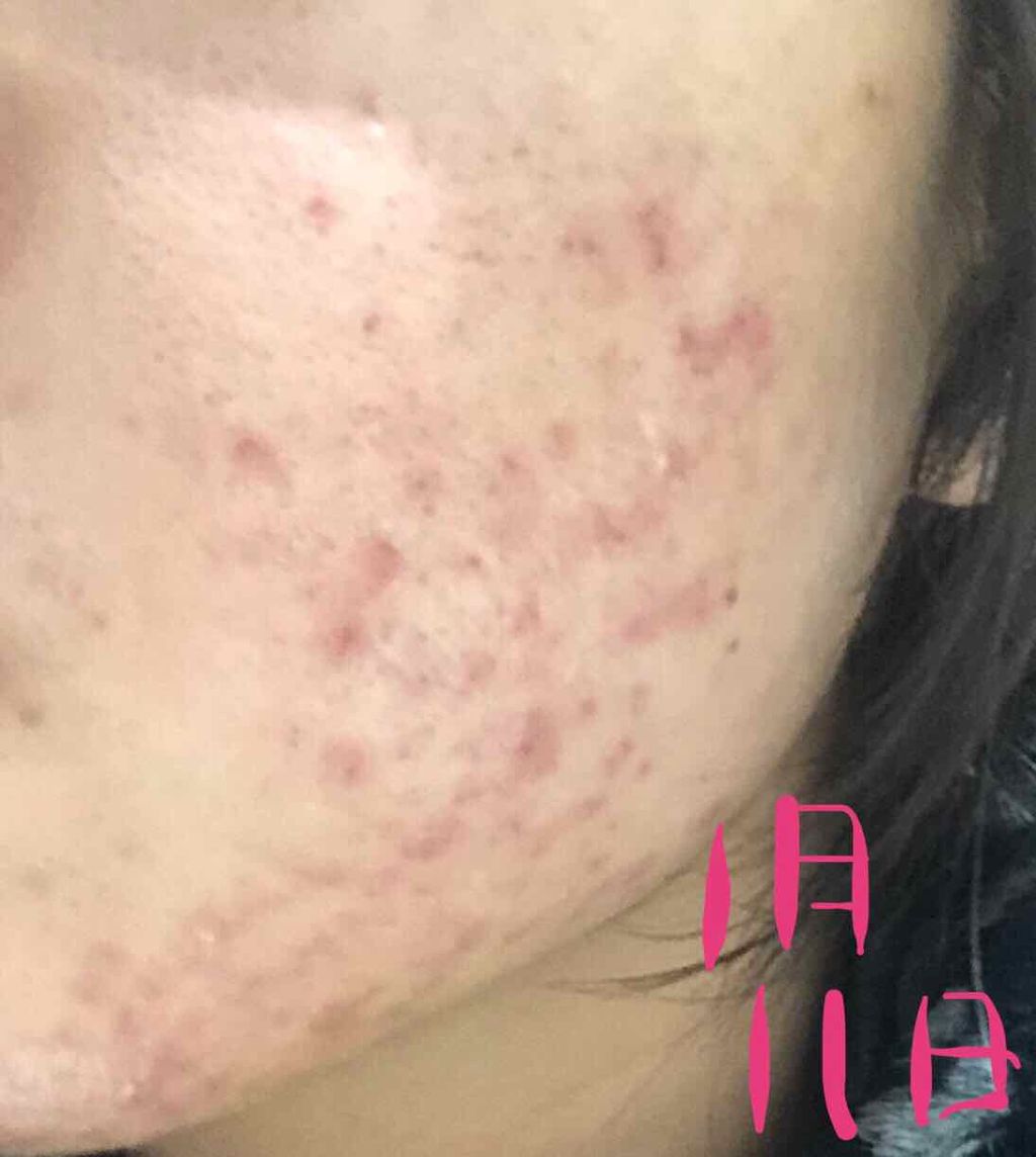 化粧水・敏感肌用・しっとりタイプ/無印良品/化粧水を使ったクチコミ(2枚目)