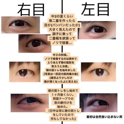ワンダーアイリッドテープ Extra/D-UP/二重まぶた用アイテムを使ったクチコミ(3枚目)