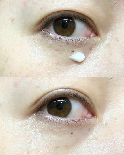 リフティアクリーム(目元用クリーム )/メザイク/アイケア・アイクリームを使ったクチコミ(6枚目)