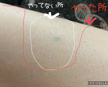 FASIZ FASIZ HAIR REMOVAL 家庭用脱毛器のクチコミ「こんにちは(  * ॑꒳ ॑*)⸝⋆｡✧♡
かめ🐢大好きかめさんです( * ॑꒳ ॑* )

.....」（2枚目）