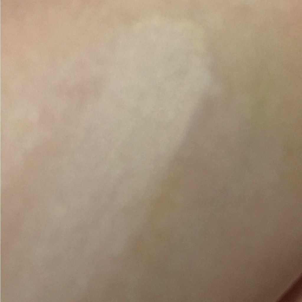 アクメディカ 薬用 フェイスパウダー ナチュラル/ナリスアップ/パウダーファンデーションを使ったクチコミ(3枚目)