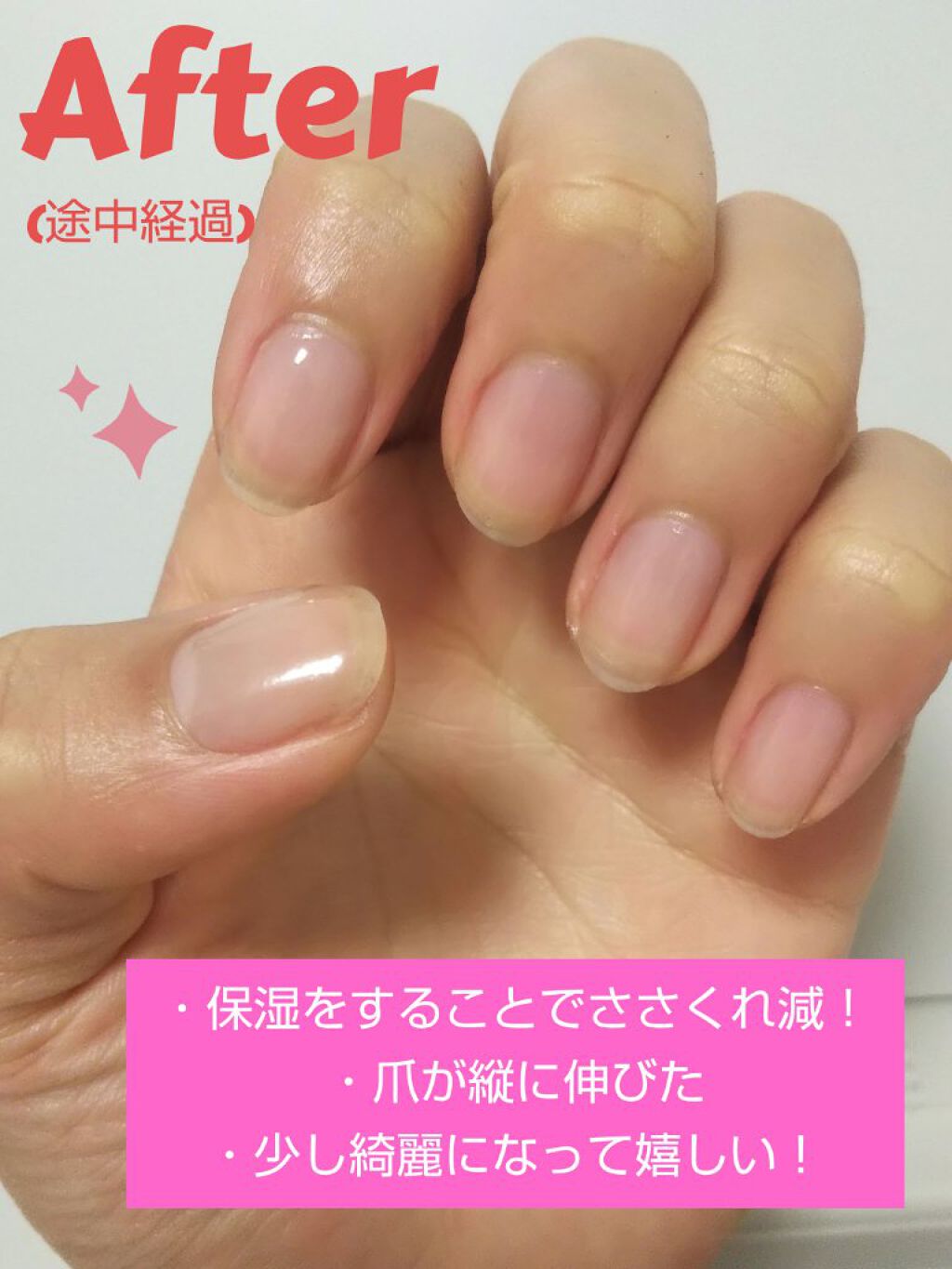 キューティクルネイルオイル ペンタイプ No Nail No Lifeを使った口コミ ゆるっと育爪生活 ずぼら人間でも続けられ By 紡ーつむぎー 脂性肌 10代後半 Lips キューティクルネイルオイル ペンタイプ No Nail No Lifeを使った口コミ ゆるっと育爪生活 ずぼら人間でも続けられ By 紡ーつむぎー 脂性肌 10代後半 Lips
