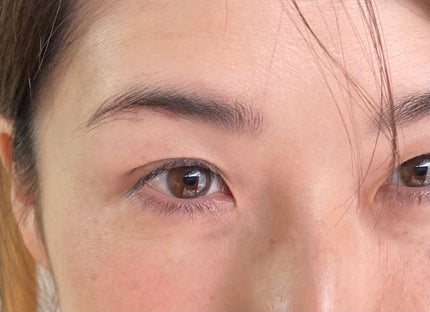 フリーファイバー120 スタンダードタイプ /メザイク/二重まぶた用アイテムを使ったクチコミ(2枚目)