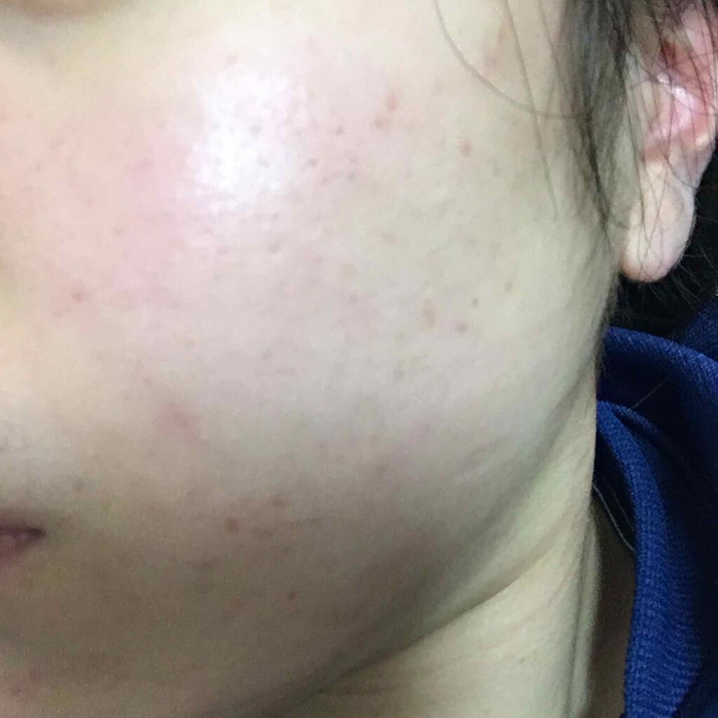 まっぷち on LIPS 「自分でも分かるぐらいピカピカになってきました家から出れないなか..」(2枚目)