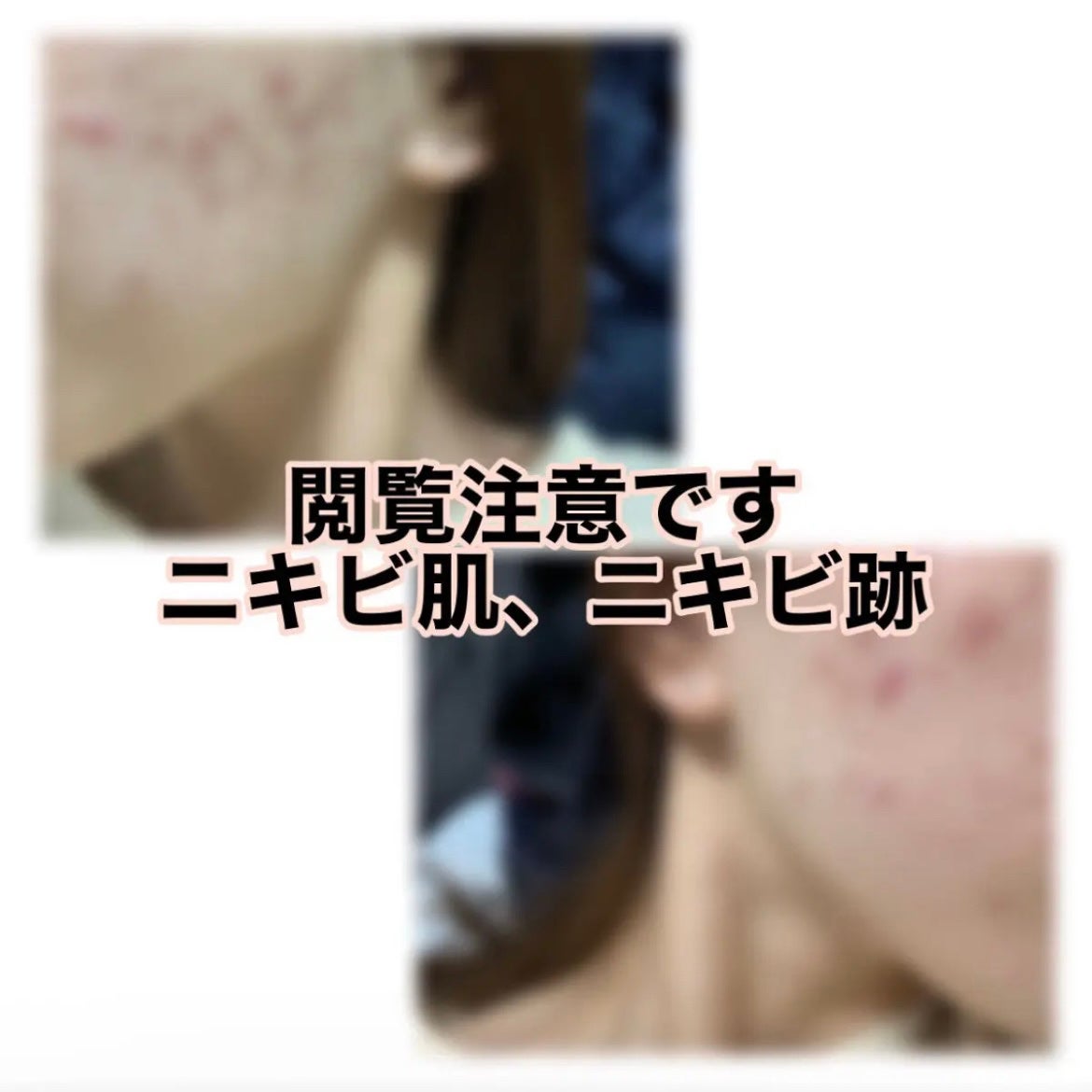 白潤プレミアム薬用浸透美白化粧水/肌ラボ/化粧水を使ったクチコミ(1枚目)