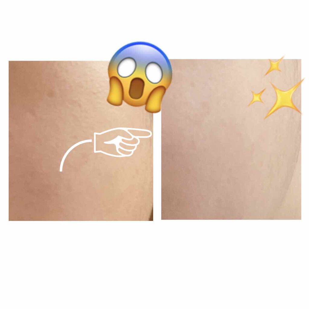 ハトムギ化粧水(ナチュリエ スキンコンディショナー R )/ナチュリエ/化粧水を使ったクチコミ（1枚目）