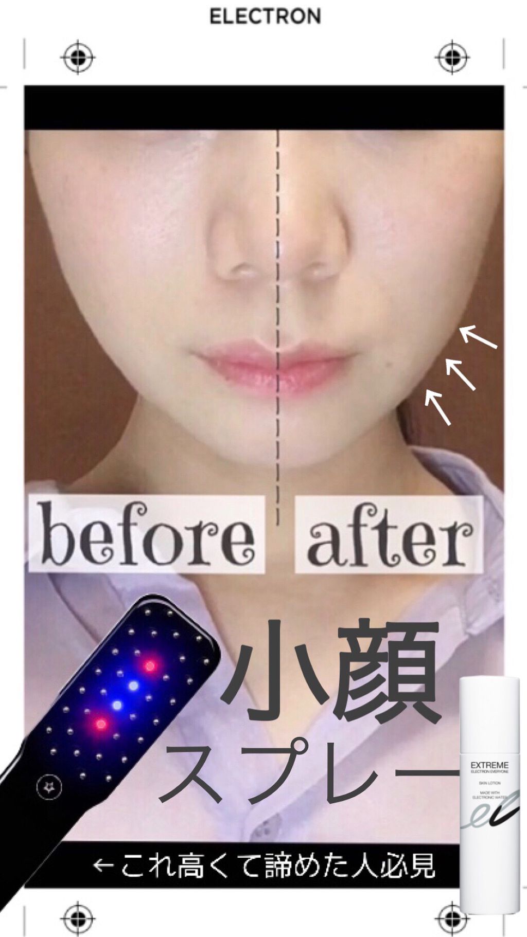 エレクトロン スキンローション/ELECTRON/ミスト状化粧水を使ったクチコミ（1枚目）