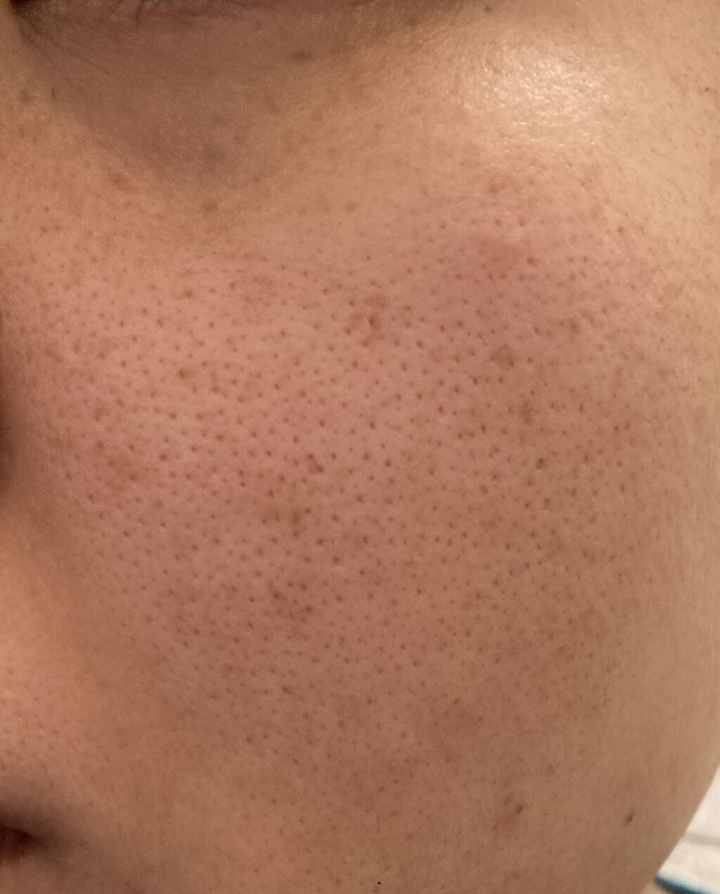 ハトムギ化粧水(ナチュリエ スキンコンディショナー R )/ナチュリエ/化粧水を使ったクチコミ（2枚目）