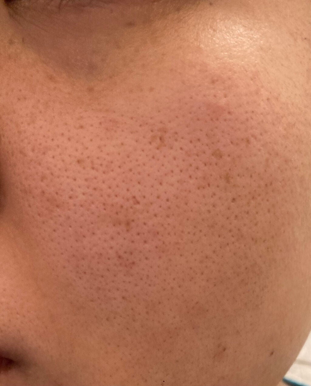 ハトムギ化粧水(ナチュリエ スキンコンディショナー R )/ナチュリエ/化粧水を使ったクチコミ(2枚目)