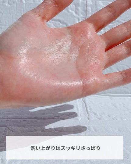 背中ニキ美クリーム/エトワラン/ボディクリームを使ったクチコミ(5枚目)