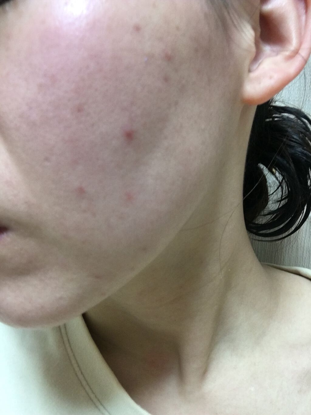 デイリーPD/ZO Skin Health/フェイスクリームを使ったクチコミ(2枚目)