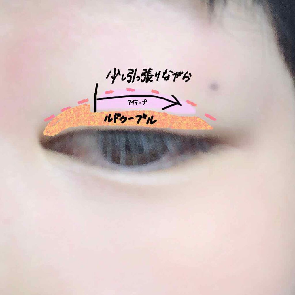 理想のふたえ きれいなライン/セリア/二重まぶた用アイテムを使ったクチコミ（2枚目）