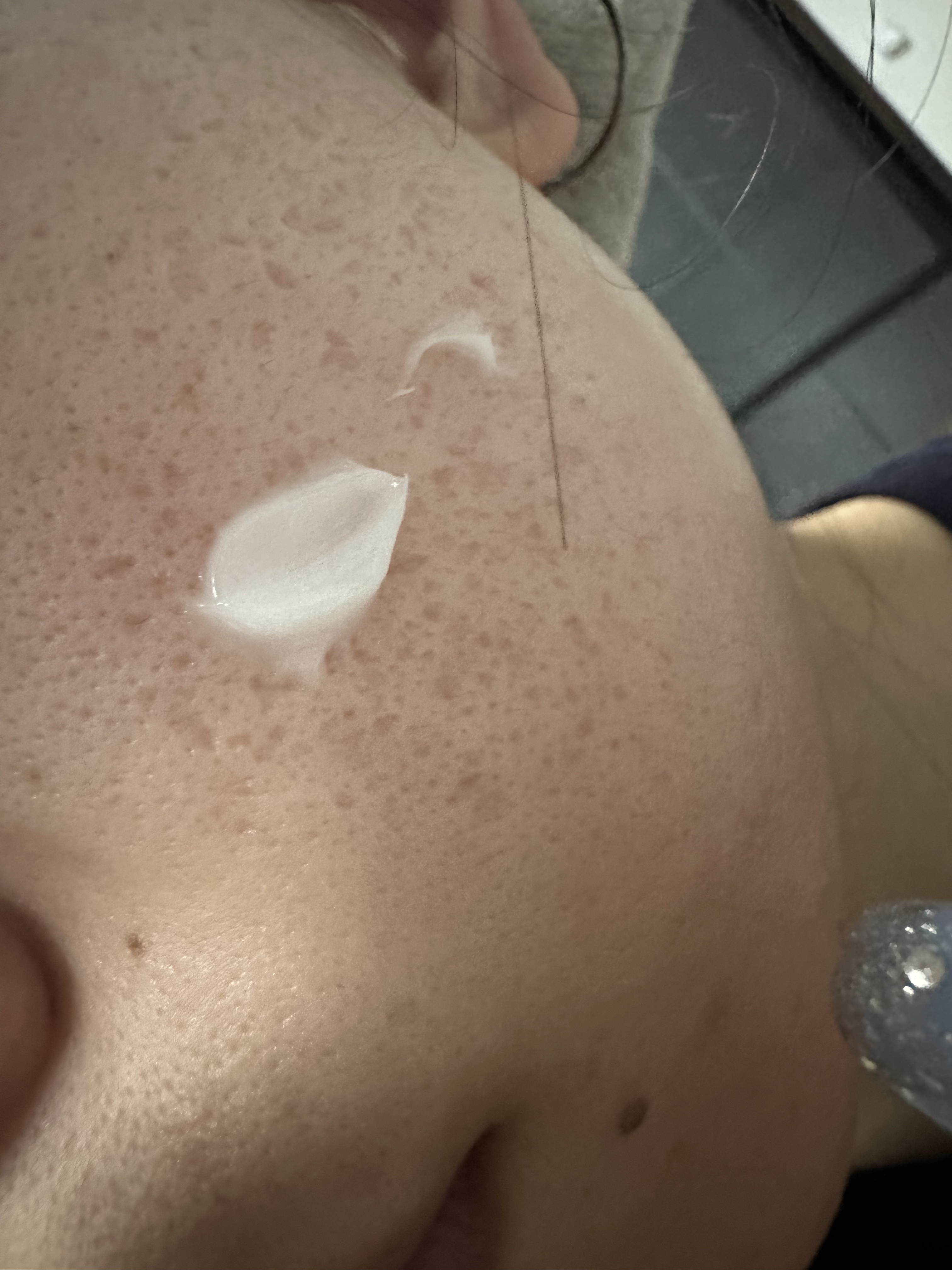 リードルショット700/VT/美容液を使ったクチコミ（3枚目）