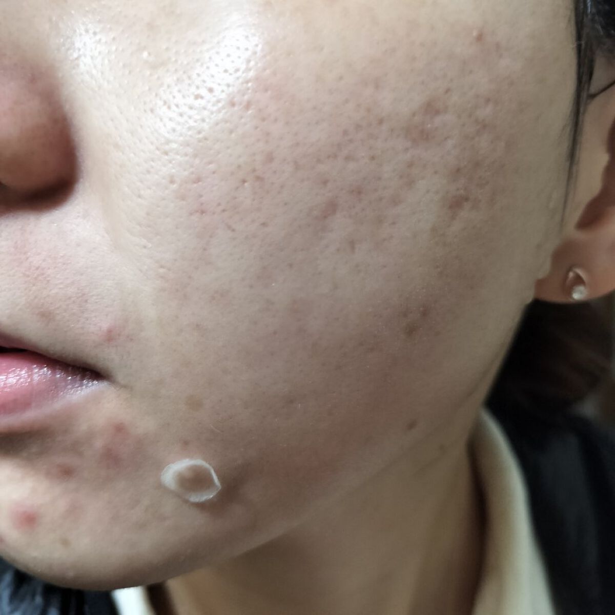 ダーマリペアシカジェルクリーム/IOPE/フェイスクリームを使ったクチコミ（2枚目）