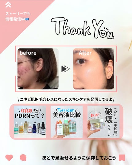 PDRNヒアルロン酸カプセル100セラム/Anua/美容液を使ったクチコミ(8枚目)