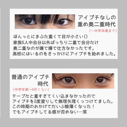 アイビューティー フィクサー WP/アストレア ヴィルゴ/二重まぶた用アイテムを使ったクチコミ(2枚目)