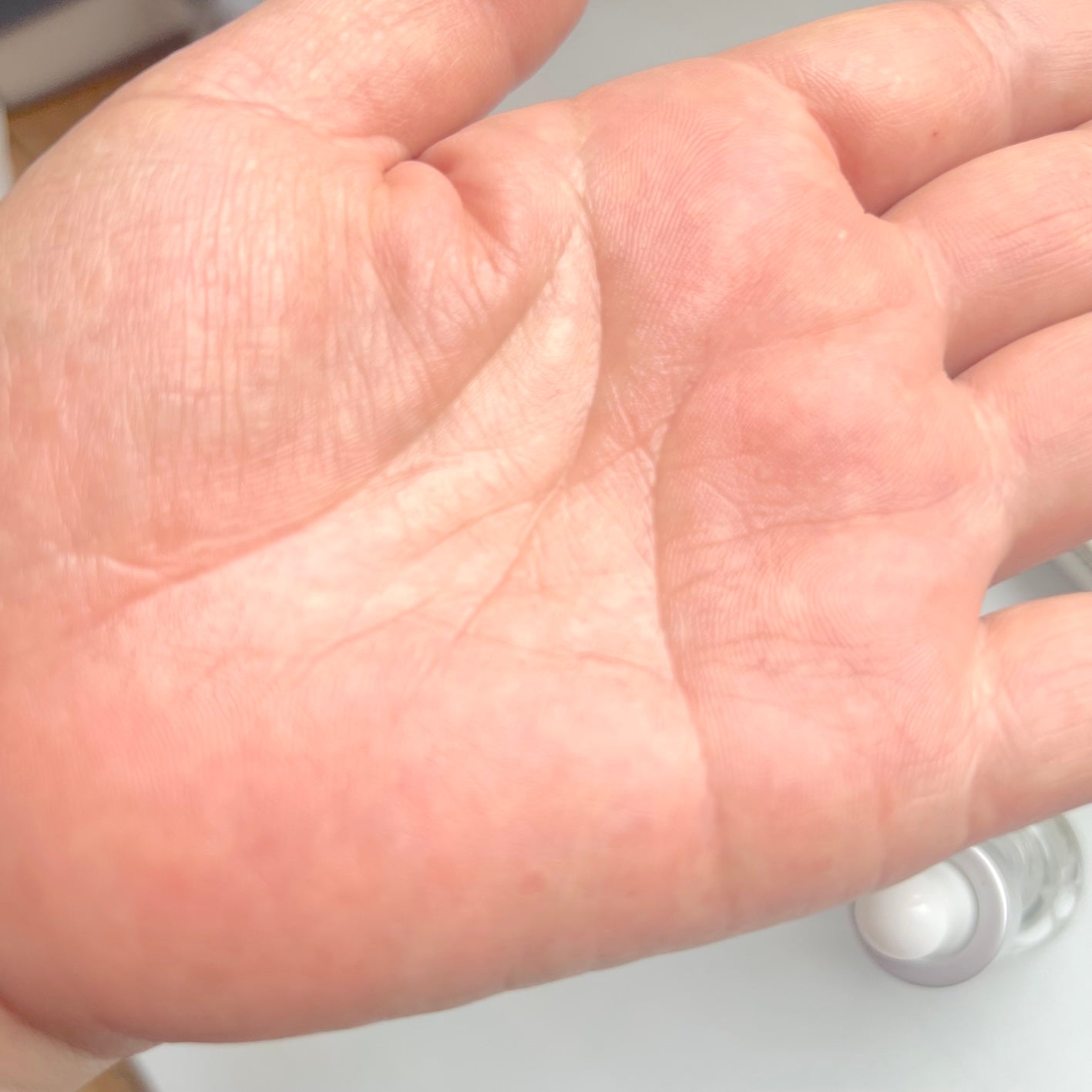 ミスクレオ on LIPS 「セラディックスの商品モニターに参加中。ニキビはできないに越した..」(6枚目)