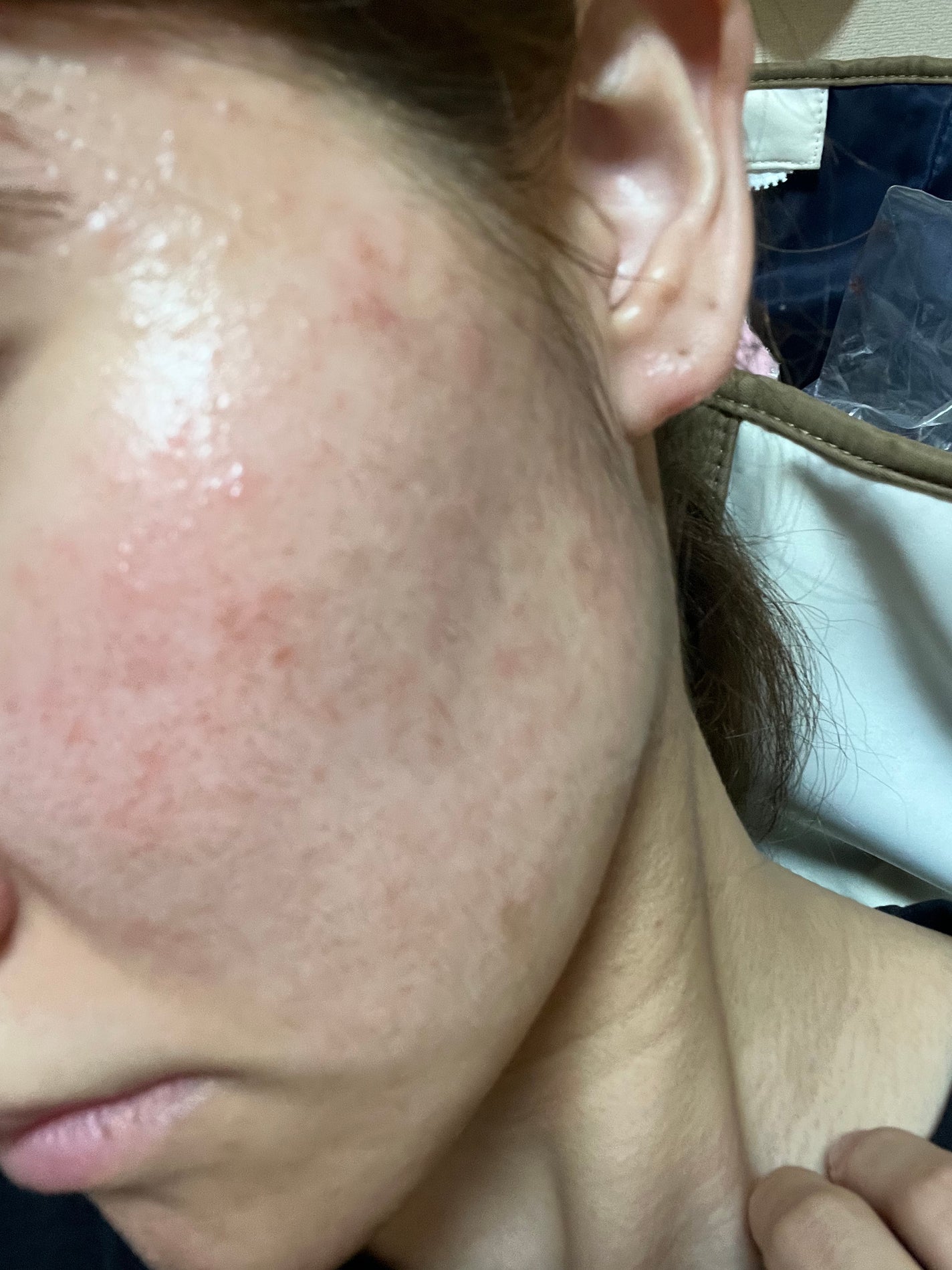 あーちゃん on LIPS 「いい商品やスキンケアあったら教えてください🙏🙇♀️どんどん日..」(1枚目)