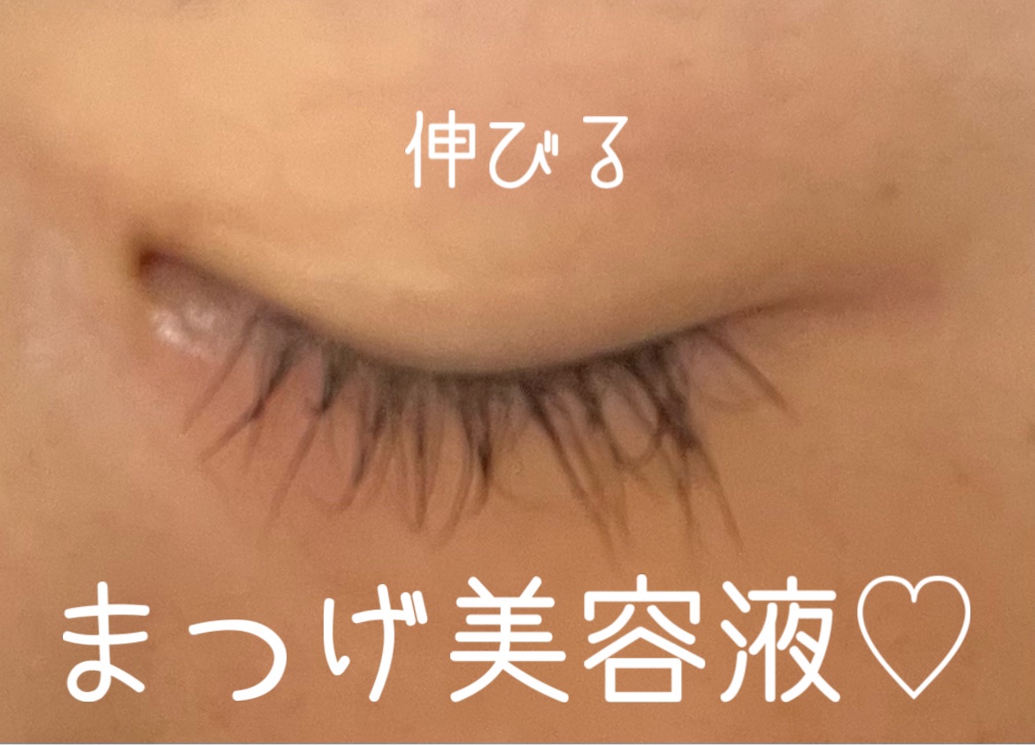 CO ロングラッシュリッチ/Co-medical+/まつげ美容液を使ったクチコミ（1枚目）