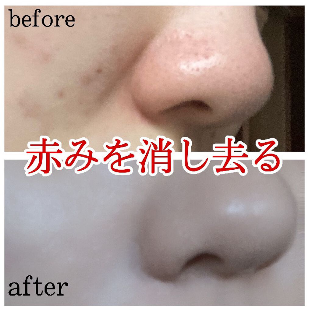 カバーパーフェクション チップコンシーラー/the SAEM/リキッドコンシーラーを使ったクチコミ(1枚目)