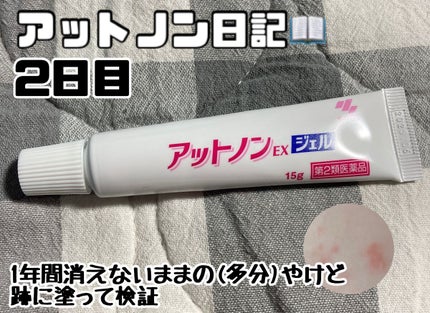 アットノンEX ジェル(医薬品)/アットノン/その他を使ったクチコミ(1枚目)