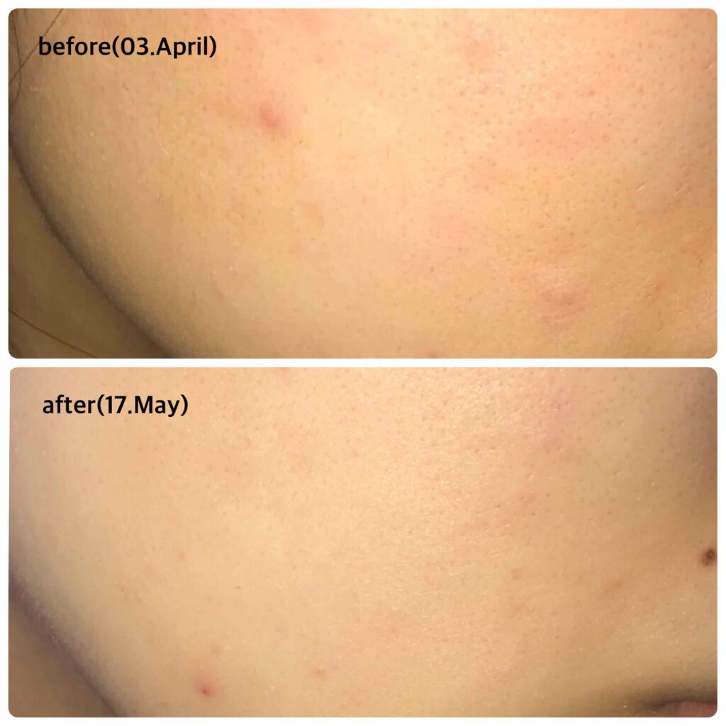 フレッシュリージュースドビタミンドロップ(35ml)/Klairs/美容液を使ったクチコミ（3枚目）