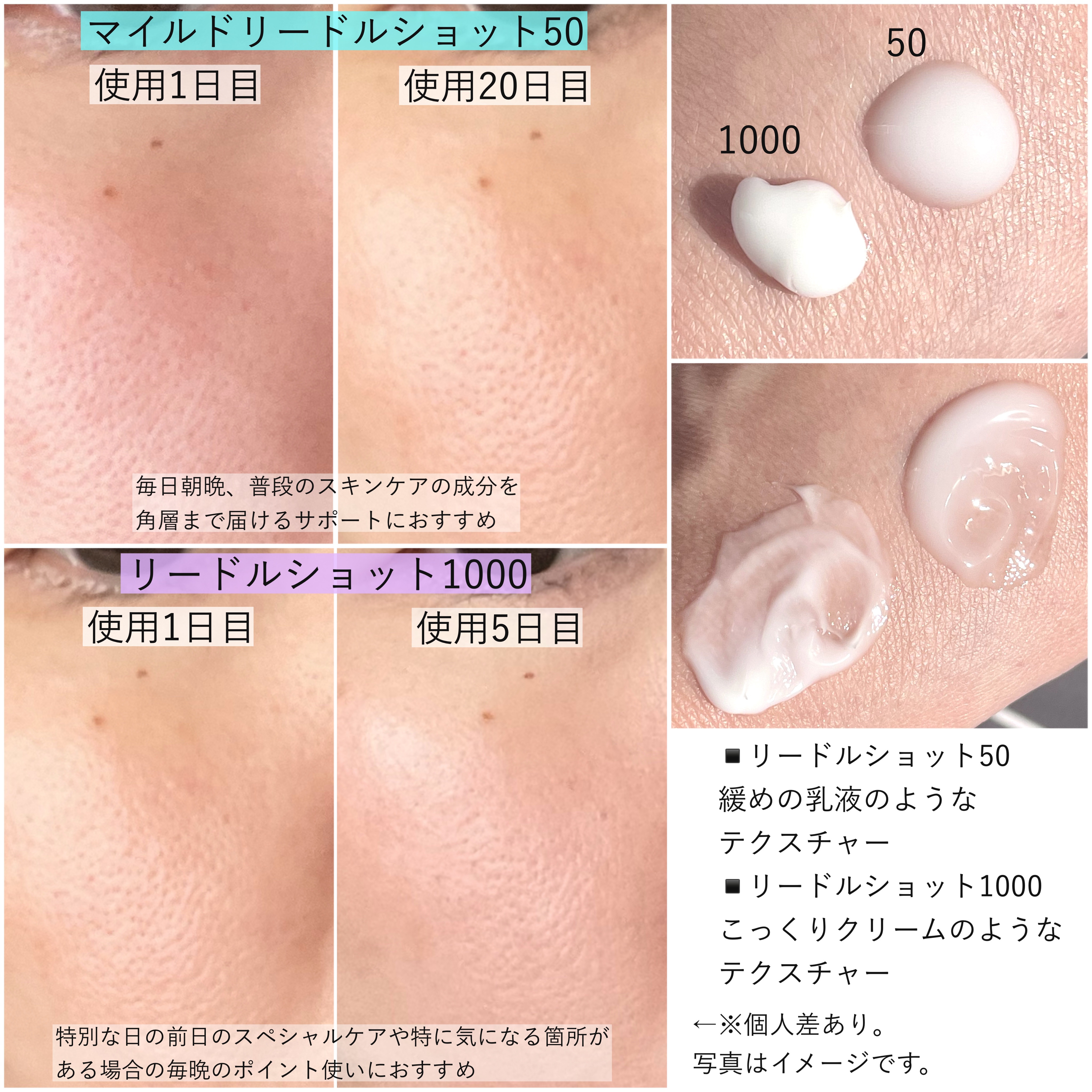 マイルドリードルショット50/VT/美容液を使ったクチコミ（3枚目）