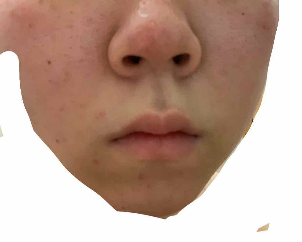 薬用スキンクリーム/オードムーゲ/フェイスクリームを使ったクチコミ(1枚目)