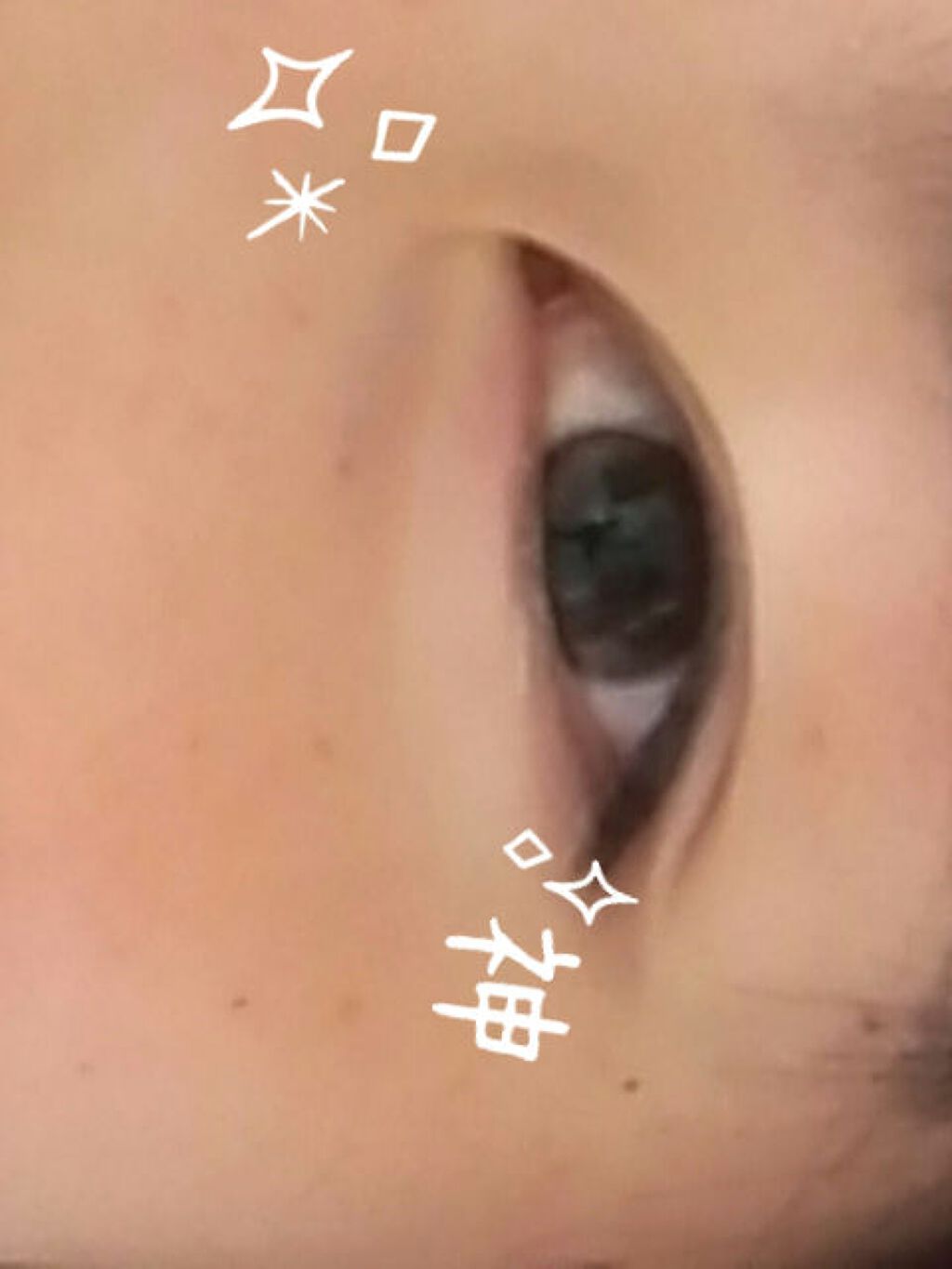 把茄 on LIPS 「私が二重に出来たコツ☆°。⋆⸜(*॑꒳॑*)⸝初投稿なのでお許..」(1枚目)