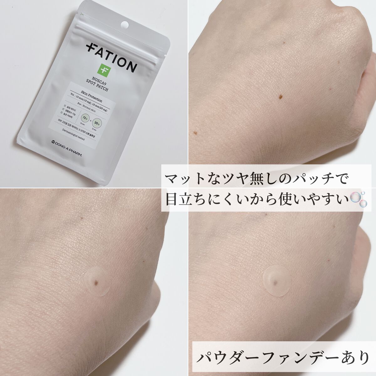 ノスカナイン スポット パッチ/FATION/にきびパッチを使ったクチコミ（3枚目）