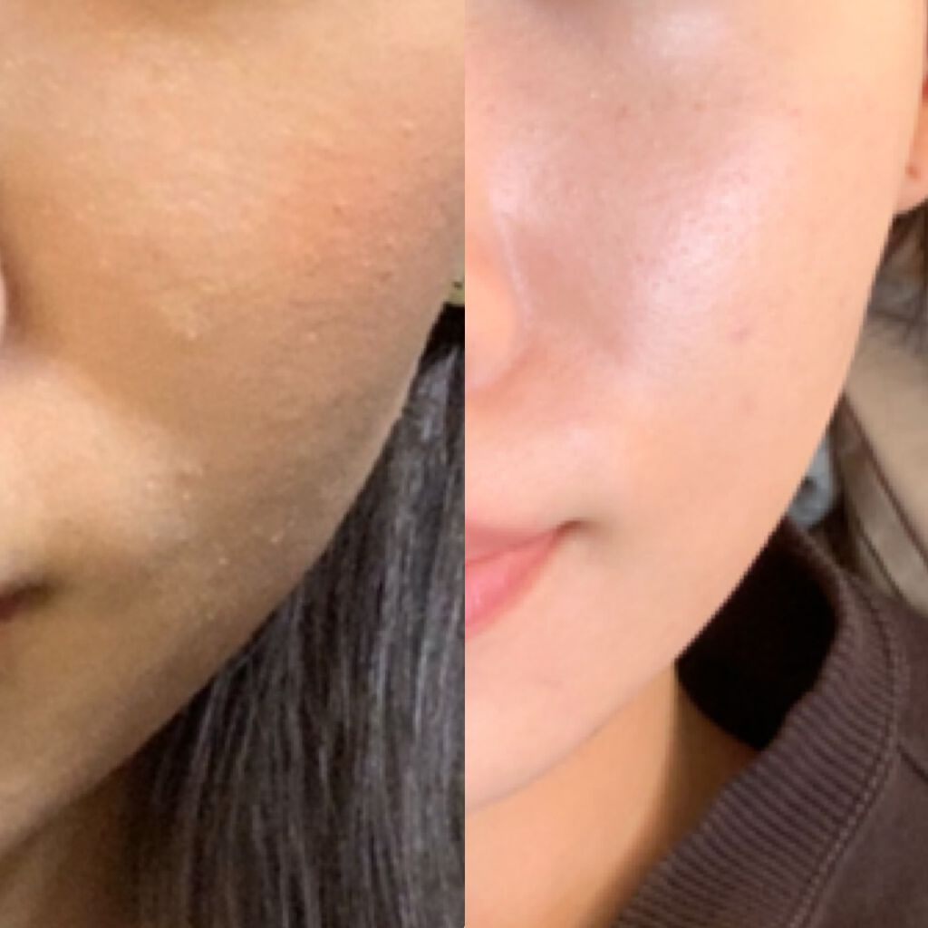 カバーパーフェクション チップコンシーラー/the SAEM/リキッドコンシーラーを使ったクチコミ(2枚目)