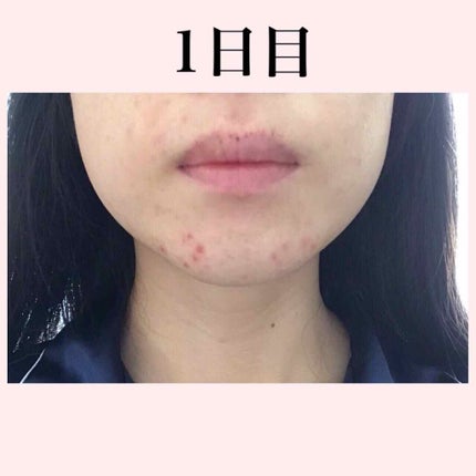 ファイバーフォーム/ルナメアAC/洗顔フォームを使ったクチコミ(2枚目)